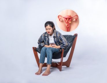 Uterine fibroids causes symptoms diagnosis and treatment options for women