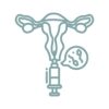 IUI (Intrauterine Insemination)